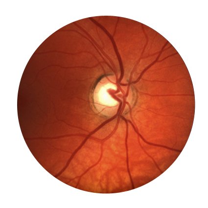 Retinal